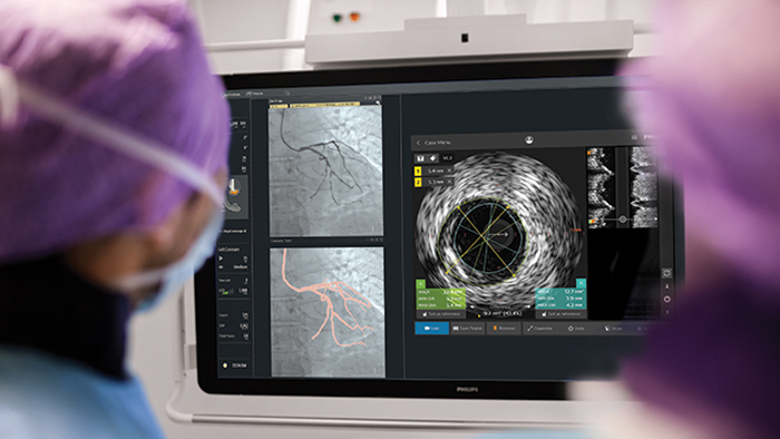 Cardi&oacute;logos realizan una intervenci&oacute;n coronaria percut&aacute;nea