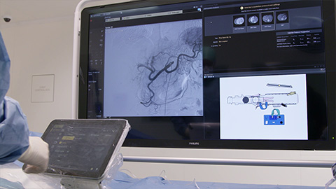Video sobre la radiolog&iacute;a intervencionista