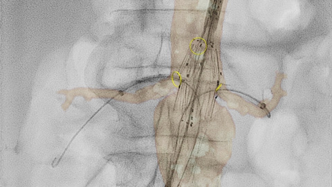 Flujo de trabajo de radiolog&iacute;a flexible